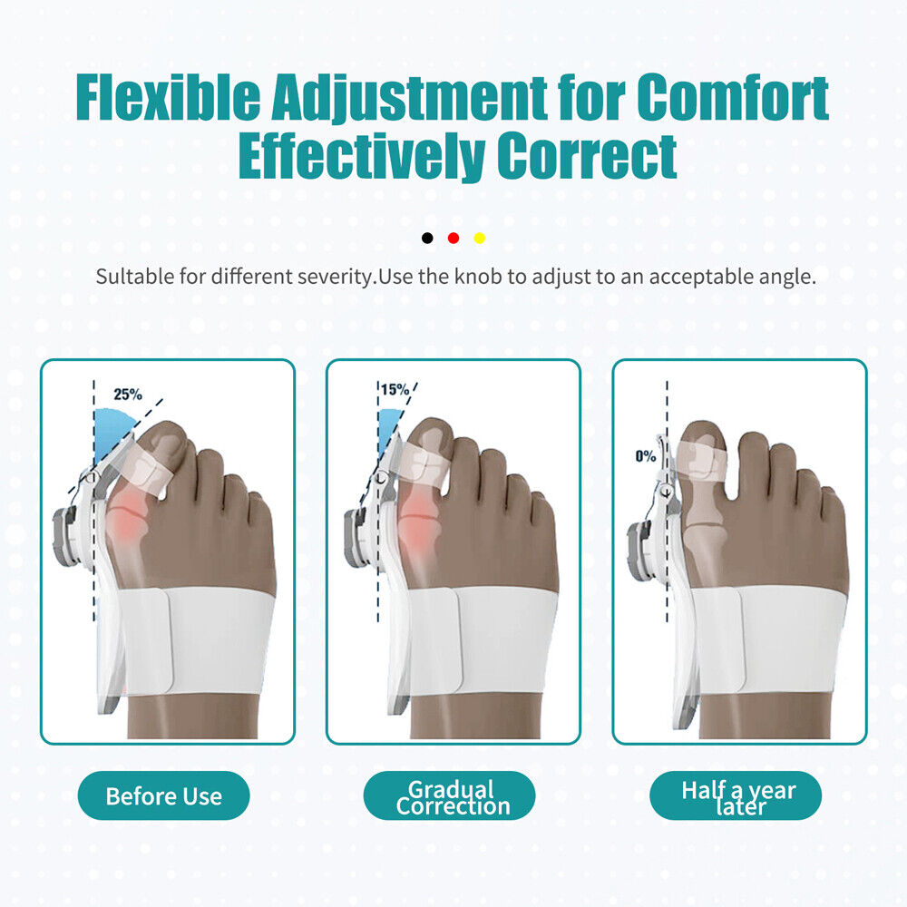 Hallux Valgus Pain Relief Support Big Toe Bunion Straightener Splint Corrector